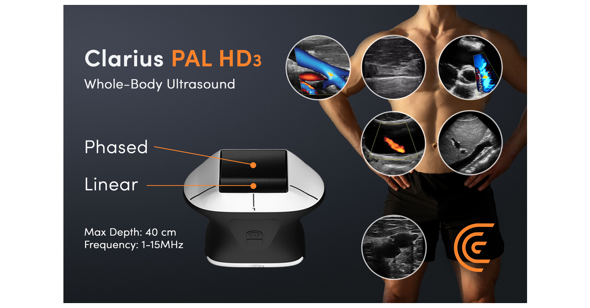 Clarius-PAL-Dual-Array-for-Whole-Body-Ultrasound